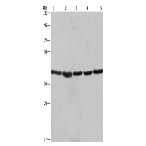RPSA rabbit polyclonal antibody