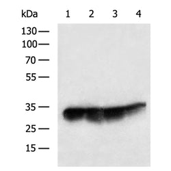 PSMD14 rabbit polyclonal antibody