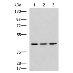 TGFB1 rabbit polyclonal antibody