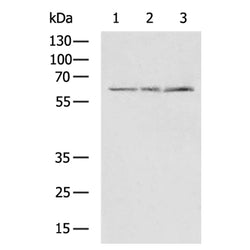 TYR rabbit polyclonal antibody