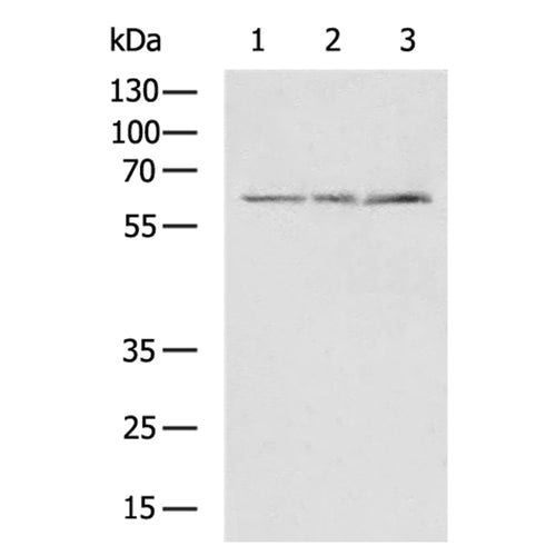 TYR rabbit polyclonal antibody