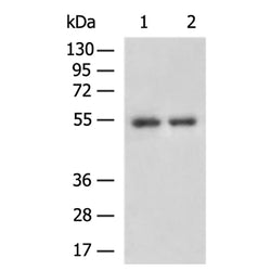 IL1RL1 rabbit polyclonal antibody