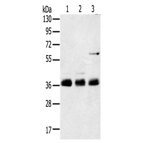 ANKRD1 rabbit polyclonal antibody