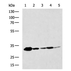 ATG5 rabbit polyclonal antibody