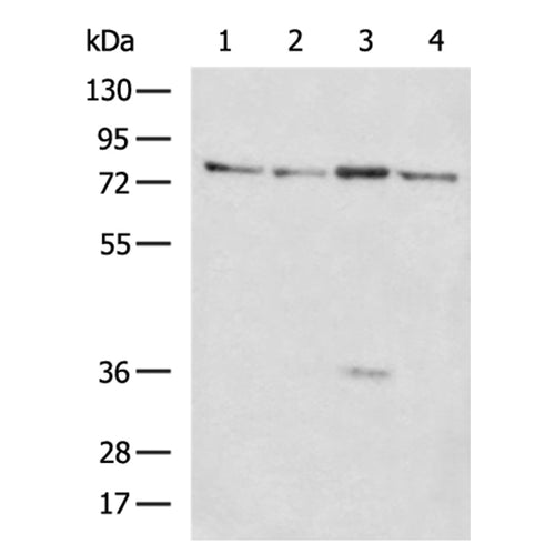 CDH6 rabbit polyclonal antibody