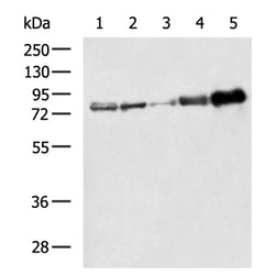 ACSL4 rabbit polyclonal antibody