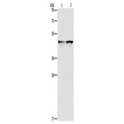 IDH1 rabbit polyclonal antibody