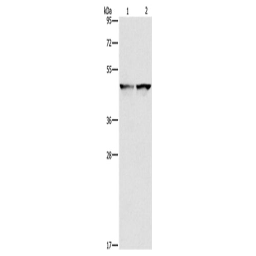 IDH1 rabbit polyclonal antibody