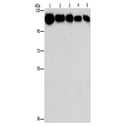 HK1/HK2 rabbit polyclonal antibody