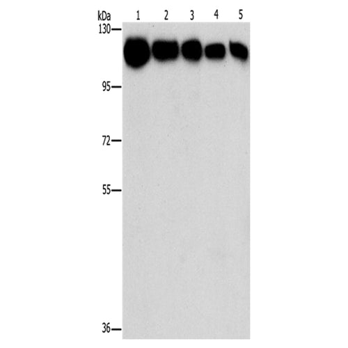 HK1/HK2 rabbit polyclonal antibody