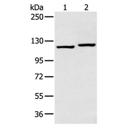 HK1 rabbit polyclonal antibody