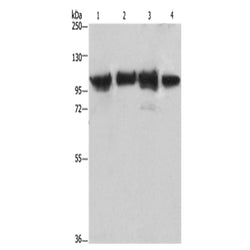 ACTN4 rabbit polyclonal antibody