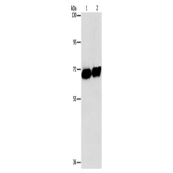 ALPP rabbit polyclonal antibody