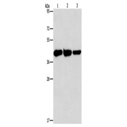 GOT1 rabbit polyclonal antibody
