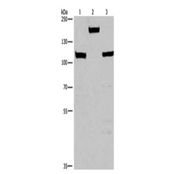 TP53BP2 rabbit polyclonal antibody