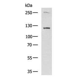 ACLY rabbit polyclonal antibody