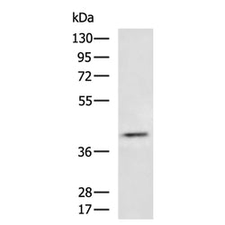 BCAT1 rabbit polyclonal antibody
