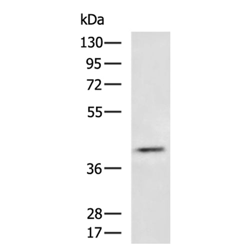 BCAT1 rabbit polyclonal antibody