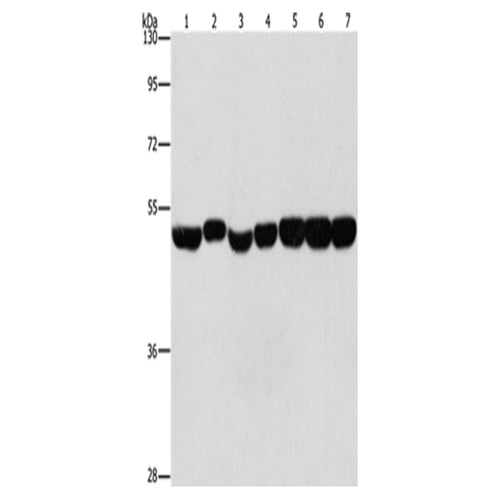 ENO1 rabbit polyclonal antibody