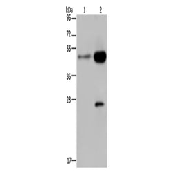 CD160 rabbit polyclonal antibody