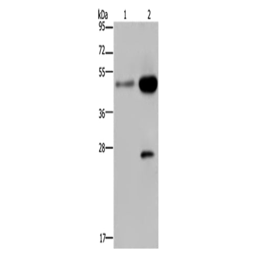 CD160 rabbit polyclonal antibody
