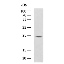 KLRB1 rabbit polyclonal antibody