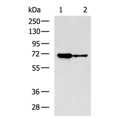 CROT rabbit polyclonal antibody