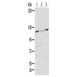 RBBP8 rabbit polyclonal antibody