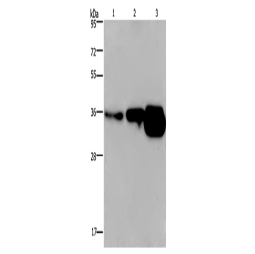 CUEDC2 rabbit polyclonal antibody