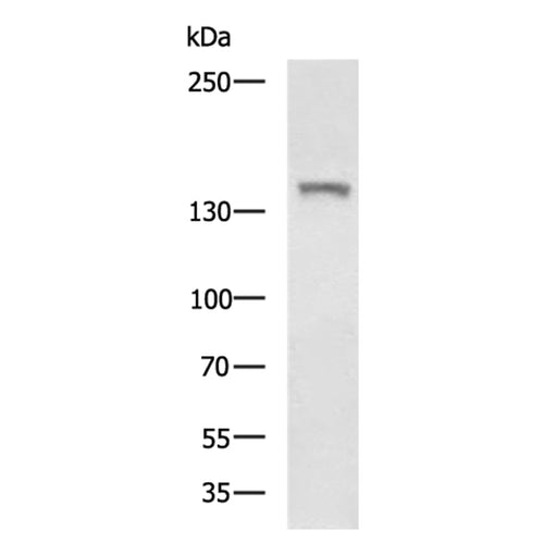 CYFIP2 rabbit polyclonal antibody
