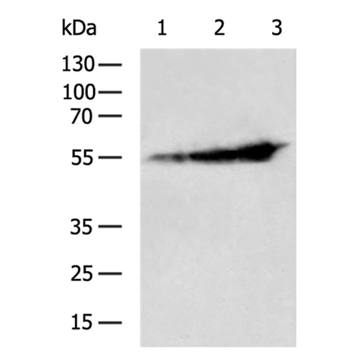 CYP2E1 rabbit polyclonal antibody