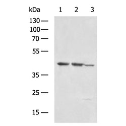 DEGS1 rabbit polyclonal antibody