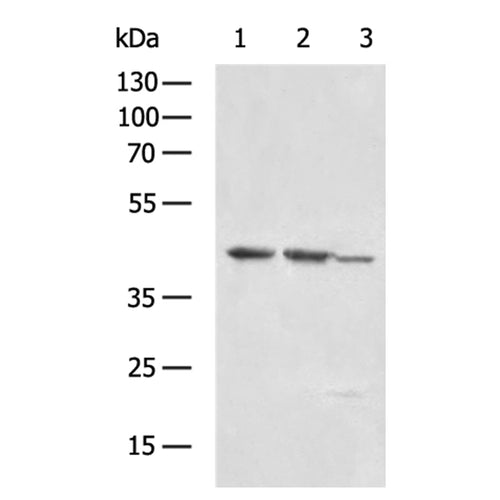 DEGS1 rabbit polyclonal antibody