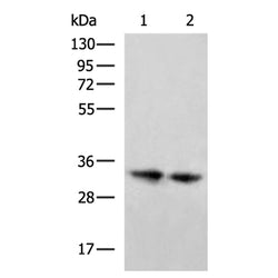 DHRS3 rabbit polyclonal antibody