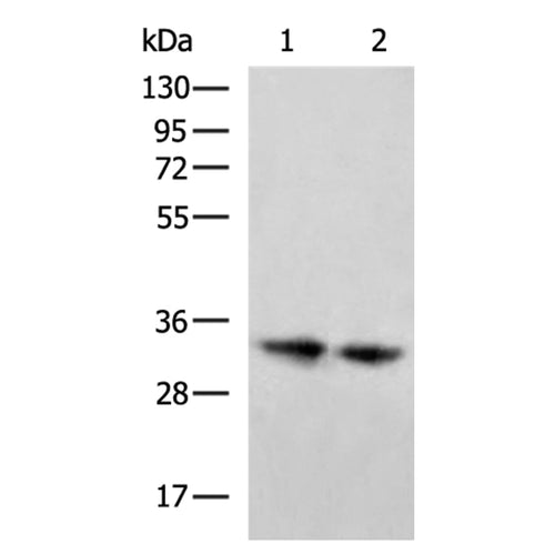 DHRS3 rabbit polyclonal antibody