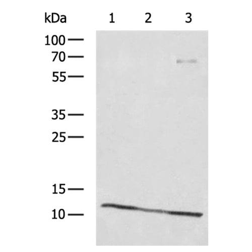 DYNLL1 rabbit polyclonal antibody