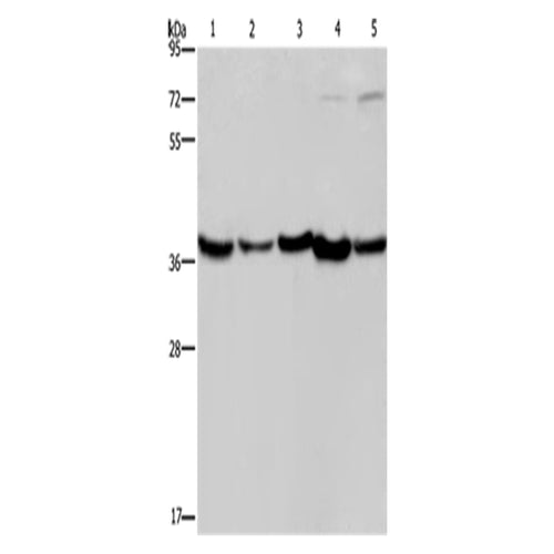 DNAJB4 rabbit polyclonal antibody