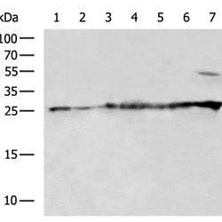 ECHS1 rabbit polyclonal antibody