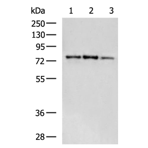 EEF2K rabbit polyclonal antibody