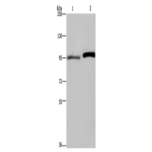 ELAC2 rabbit polyclonal antibody