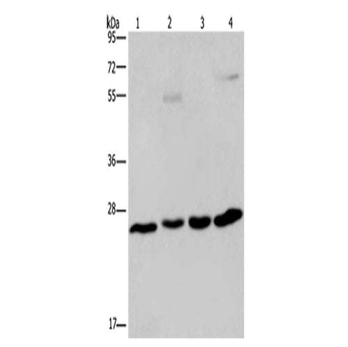 ETHE1 rabbit polyclonal antibody
