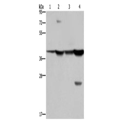 FBP1 rabbit polyclonal antibody