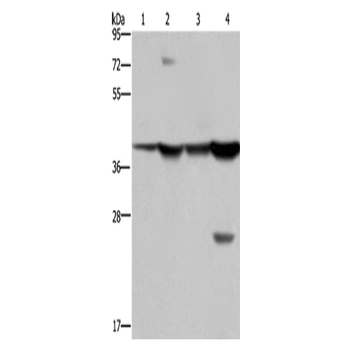 FBP1 rabbit polyclonal antibody