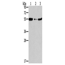 FGFR1OP rabbit polyclonal antibody