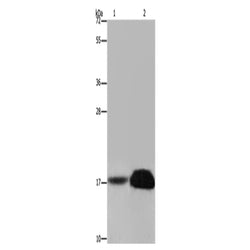FHIT rabbit polyclonal antibody