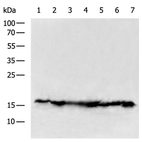 FIS1 rabbit polyclonal antibody