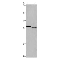 FRK rabbit polyclonal antibody