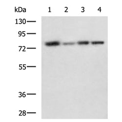 GGCX rabbit polyclonal antibody