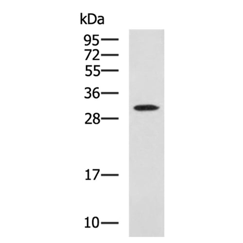 GLIPR1 rabbit polyclonal antibody