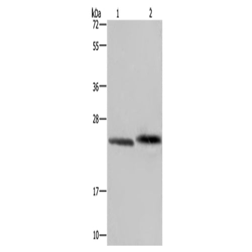 GLO1 rabbit polyclonal antibody